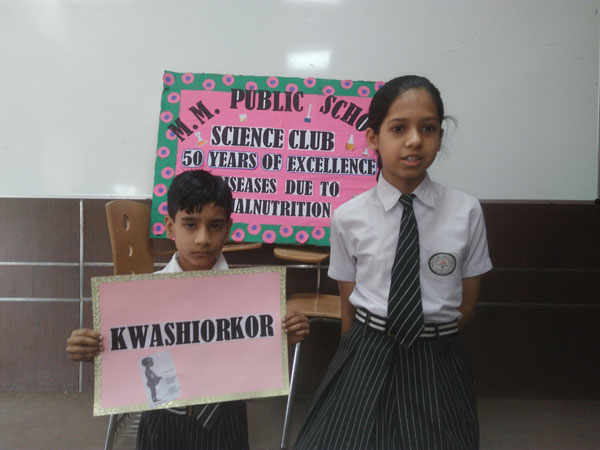 Study of various Diseases due to Malnutrition by Science Club